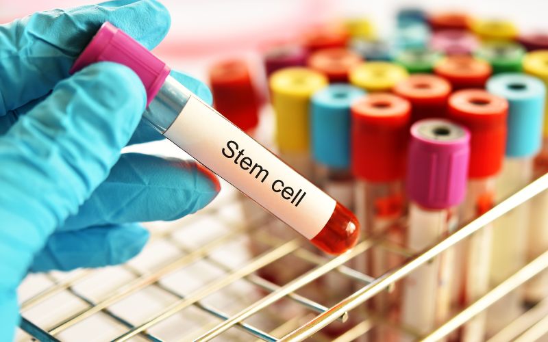 Stem Cell Banking Preservation Cost: Securing Health for the Future
